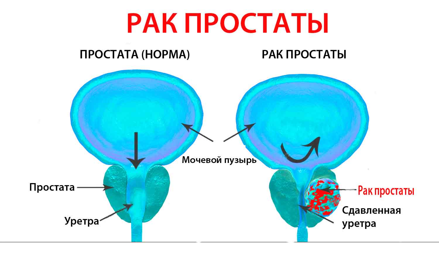 Красные пятна на половом члене: что это значит?